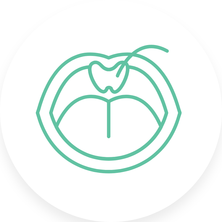 MisOtorrinos_Servicios_CirugiaAmigdalas